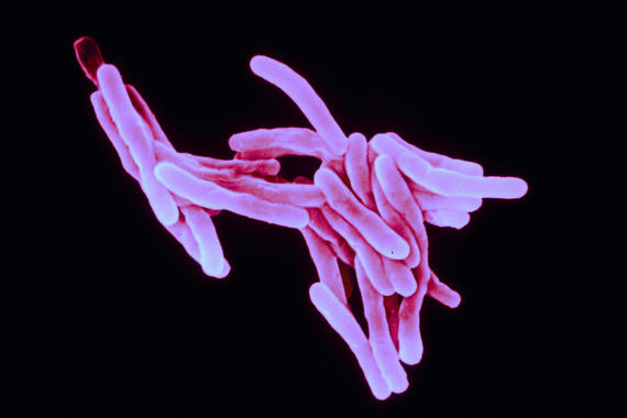tuberculosis_vacuna_candidata